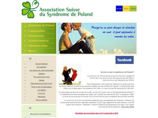 thumb Association Suisse du Syndrome de Poland